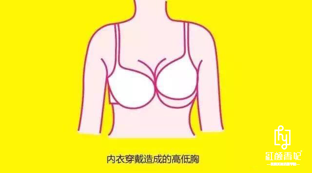 乳房不对称
