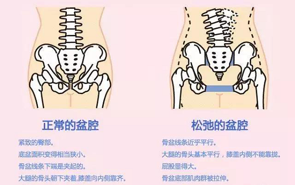 产后骨盆恢复重不重要？