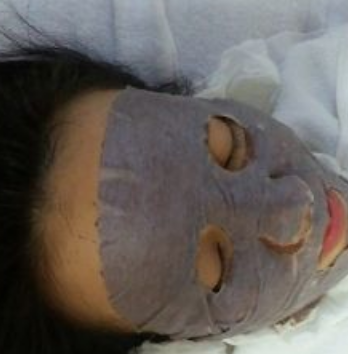 祛痘護(hù)理安全
