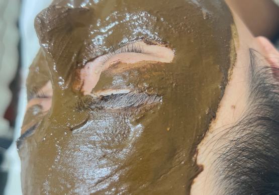 科茵特祛斑祛痘